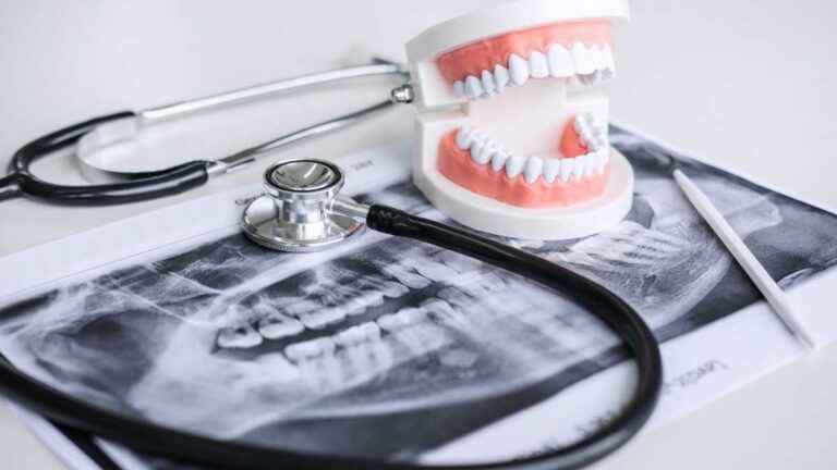 Cirurgia Buco Maxilo Facial